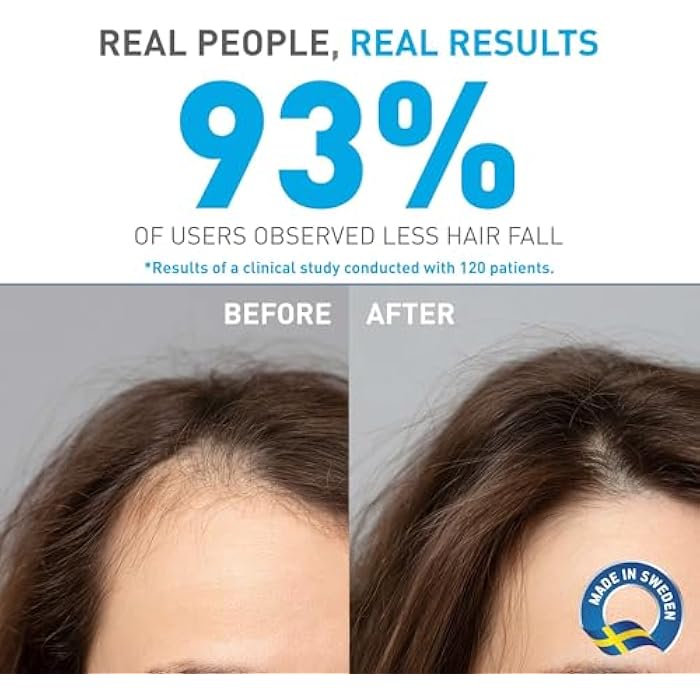 Bionnex Org Anti-Hair Loss Shamp.Dandruff 300Ml - Image 3